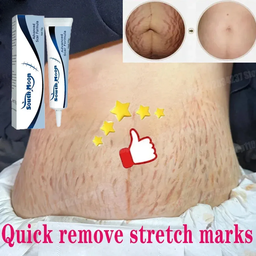 

Pregnancy belly cream repairs skin, removes stretch marks, moisturizes, anti-aging, removes stretch marks and improves skin