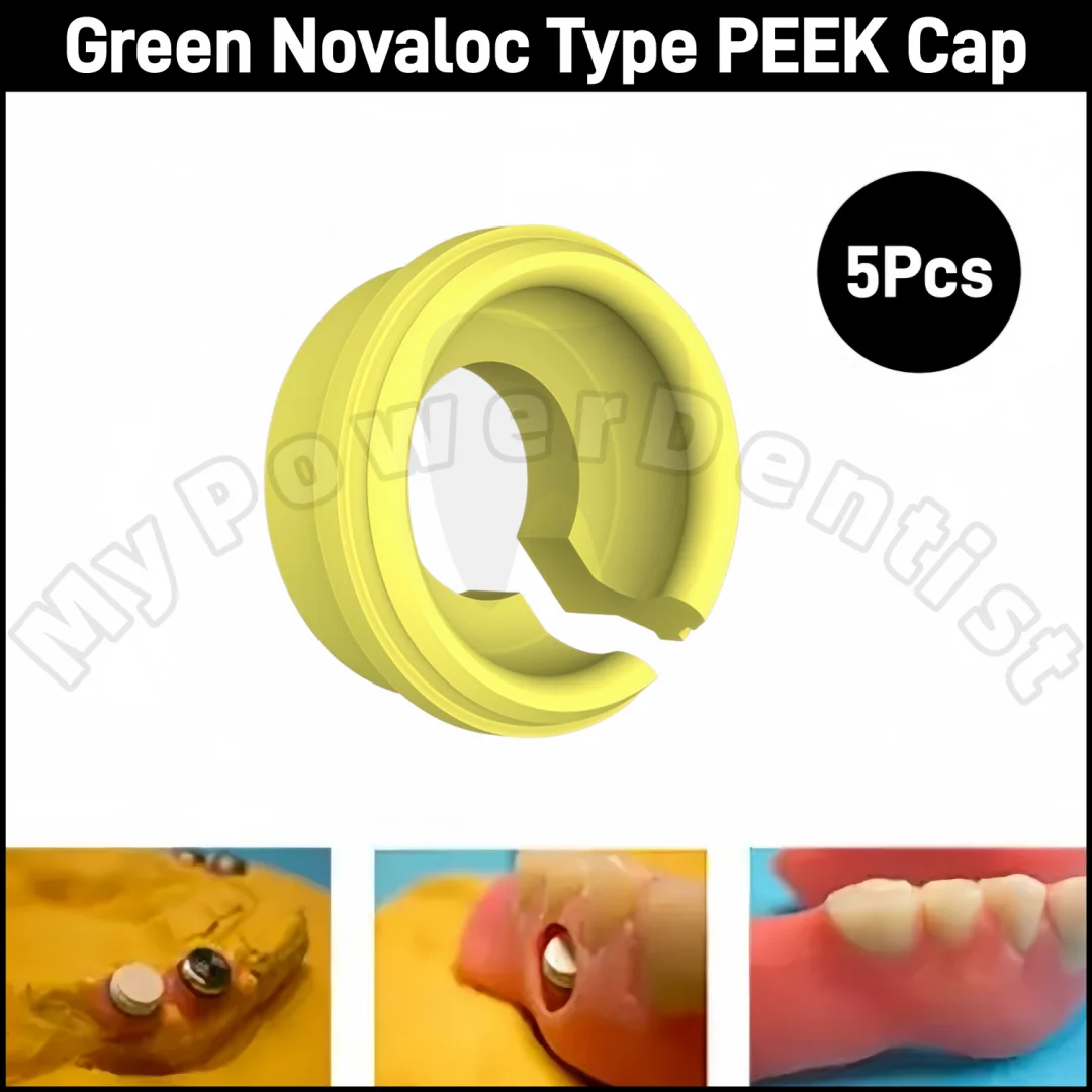 

5 шт. Заглушки для дентальных имплантатов из PEEK, титановые колпачки-корпуса, желтые фиксирующие вставки, тип Novaloc, материал для дентальных имплантатов
