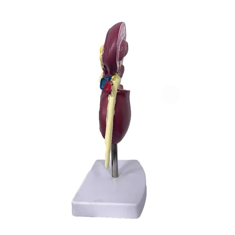 Life Size Kidney Pathologies Model Human Body Anatomy Replica of Diseased Kidney Medical Office Supplies Educational Tool