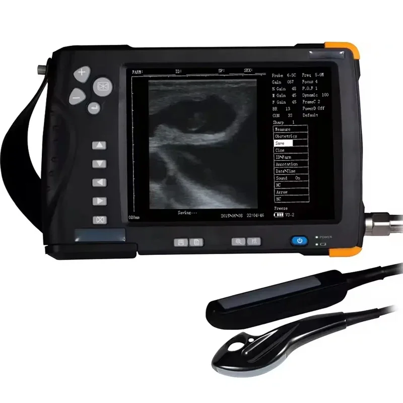 

Portable Veterinary Ultrasound with Digital Image Enhancement for Livestock