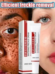 Face Dark Spots Remover for Women Remove Melasma Freckles Cream Removal Melanin Whitening Cream Fade Spots Skin Brightening Care