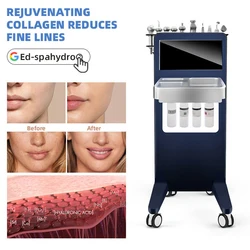 10 in 1 Skin Management Hydra Dermabrasion Machine Oxygen Aqua Peel H2O2 Exfoliating Face Clean Hydrating Machine for Skin Youth