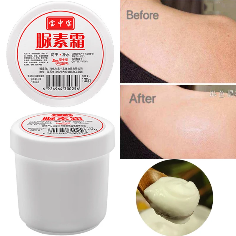 

2pcs Urea Cream To Chicken Skin Body Lotion Moisturizing Whitening Dry Heel Hand Body Cream And foot Care Heel Cracked Repair