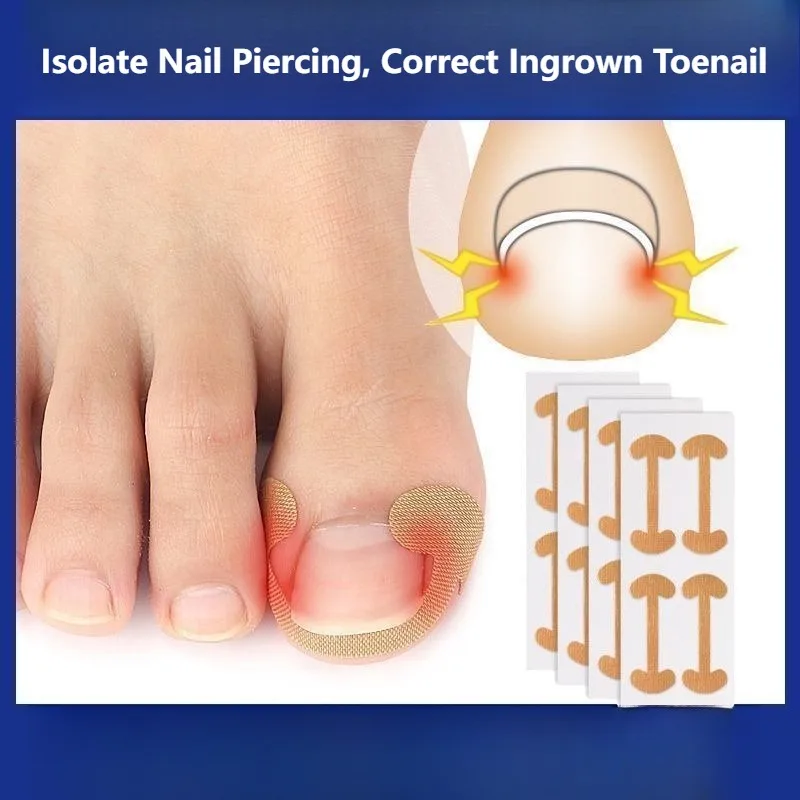 Toenail Corrector Patch Toe Nail Correction Sticker Silicone Lifter Pad Foot Health Care Tool Painless Comfortable Flexible