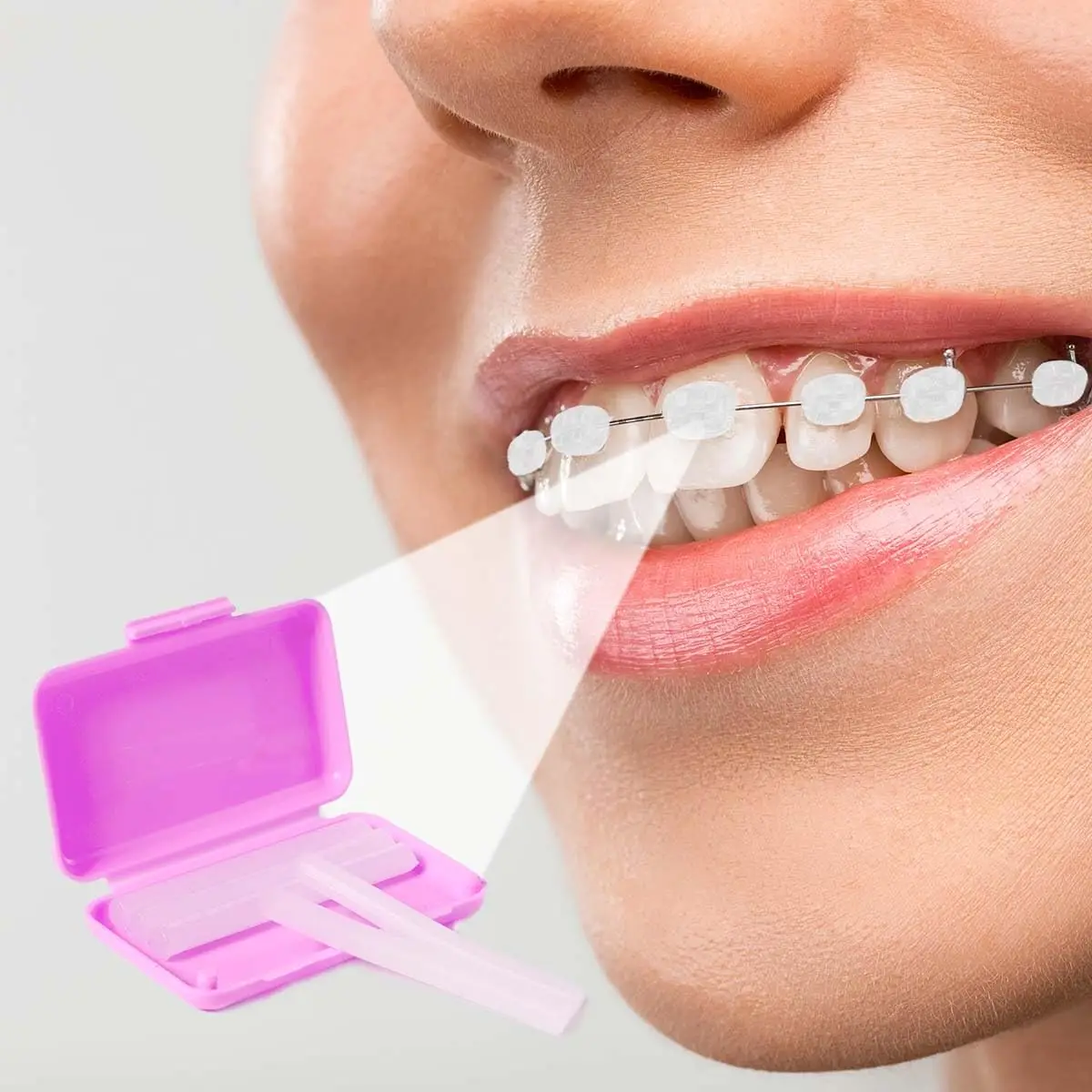 شمع الأقواس الملون للعناية بالأسنان شمع تقويم الأسنان لارتداء الأقواس ، شمع تخفيف تقويم الأسنان #6