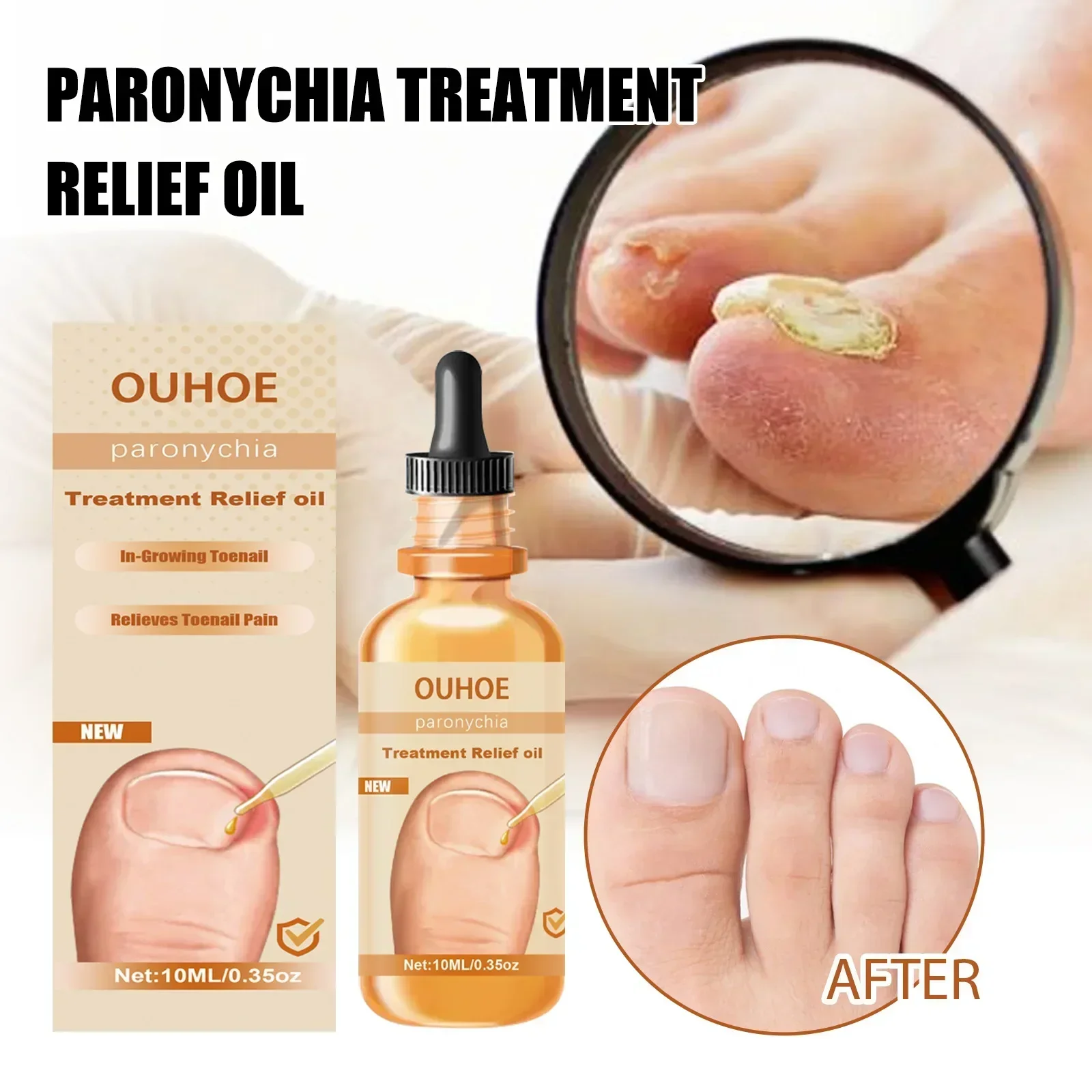 Uñas Nail Strengthener Renewal Nighttime Nail Essence 10ml Restores Appearance of Discolored or Damaged Nails Nail Renew Care