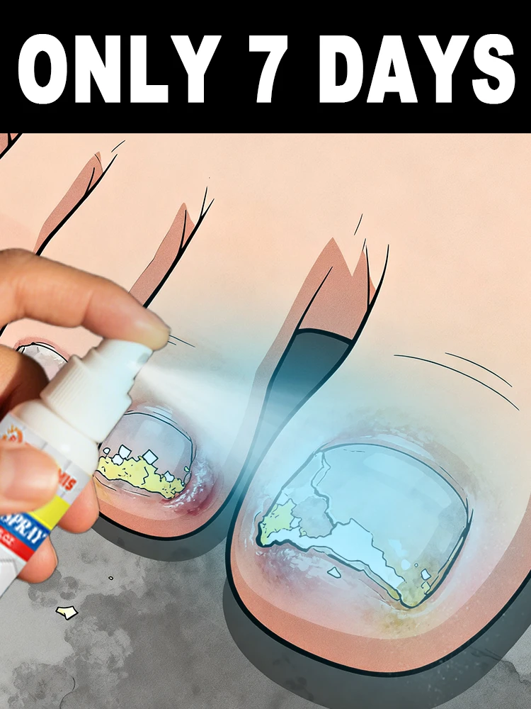 

It can quickly soften damaged nails ᵃⁿᵈ ᶜˡᵉᵃⁿ ᵃʷᵃʸ ˢᵗᵘᵇᵇᵒʳⁿ ᶠᵘⁿᵍⁱ ᵘⁿᵈᵉʳ ᵗʰᵉ ⁿᵃⁱˡˢ‧