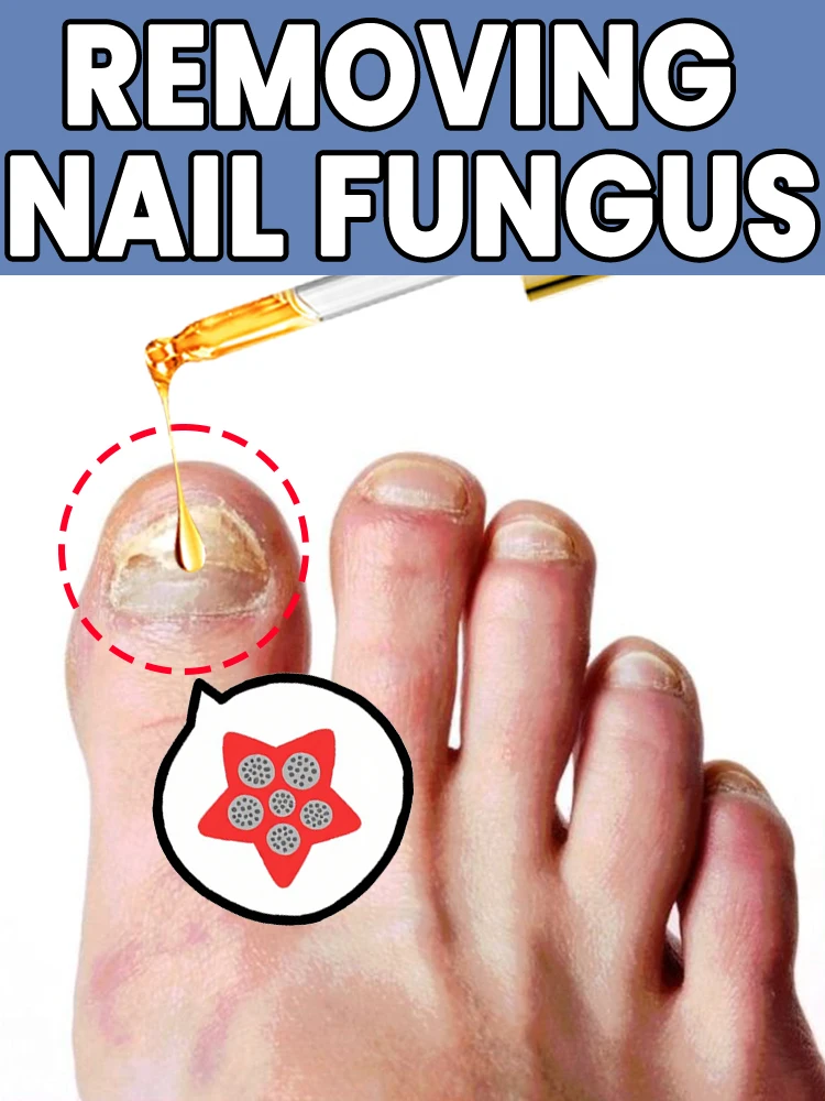 

Regenerator Treatment Device - Fungus Prevention Technology Restores Nail Health - Adjustable Control and Safety Tool