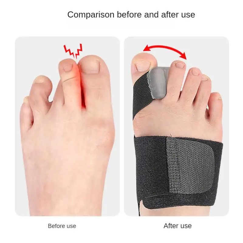 1/2/3pcs Hallux Valgus Corrector One Side Thumb Valgus Corrector Tension Strap Pain Relief Toefinger Separator Toe Straightener