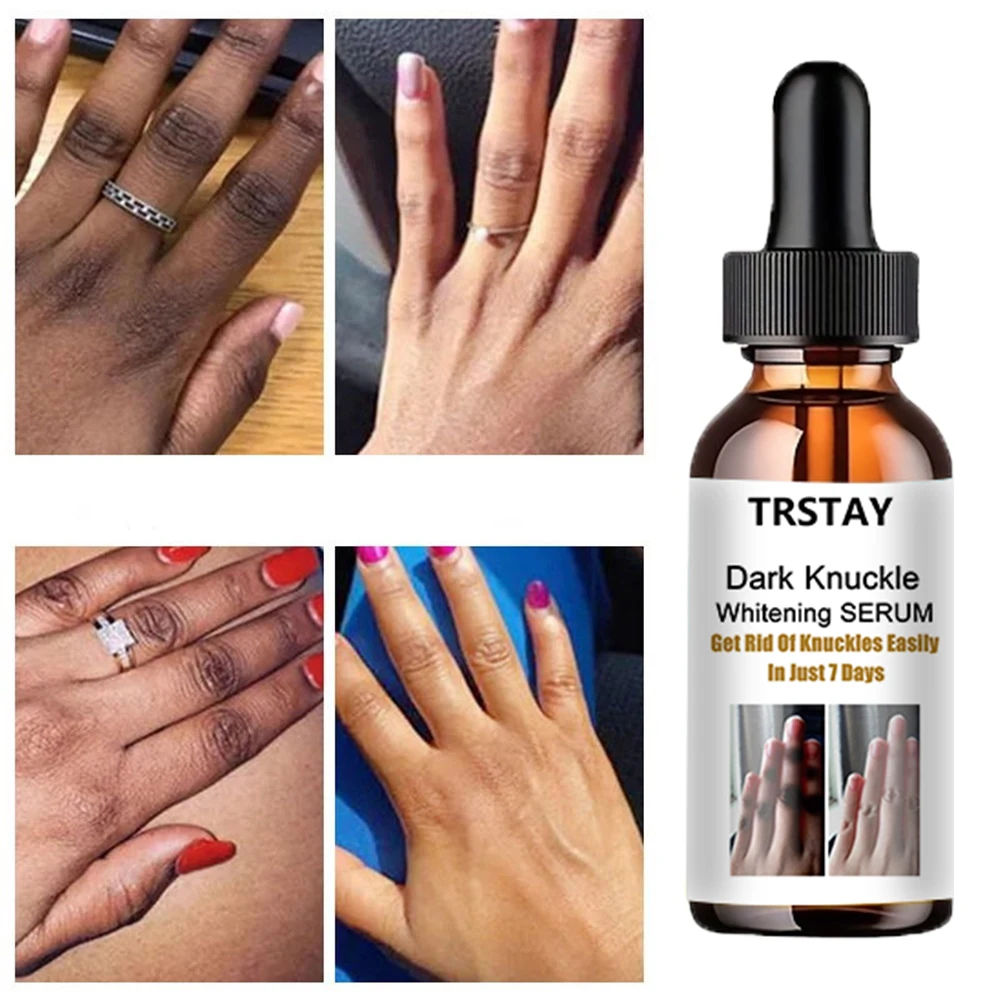 TRSTAY Black Finger Joint Whitening Serum can easily get of finger joints in just 7 days