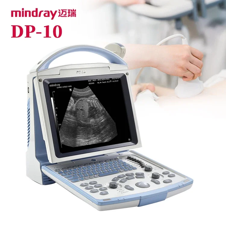 Portable Ultrasound Machine Mindray DP-10 Black and White ultrasound Scanner