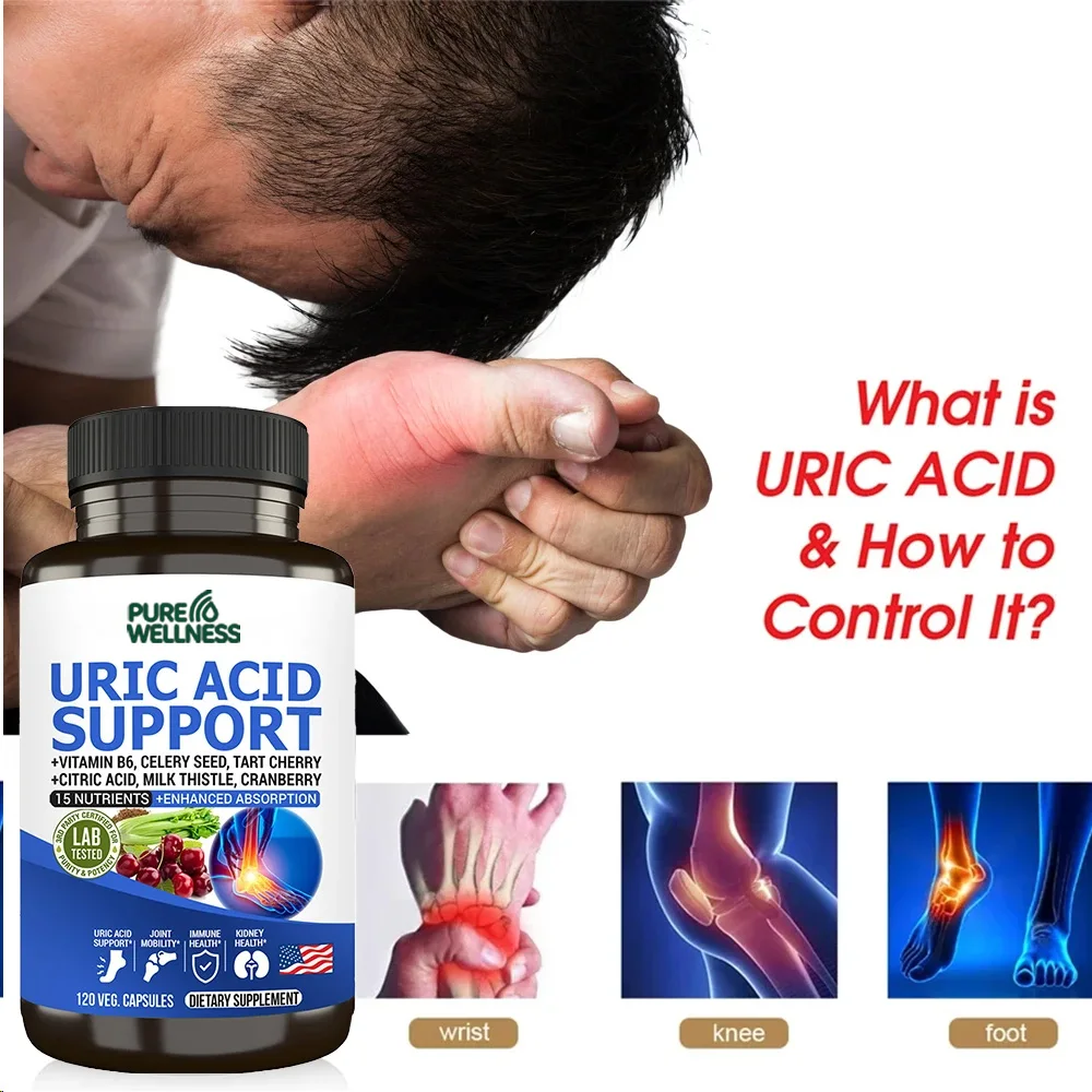 كبسولات إزالة السموم لتنظيف حمض اليوريك - مكمل غذائي يومي يساعد على توازن الكلى وتعزيز المسالك البولية