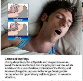 Anti Snoring Nasal Strips for Men Women, Upgraded Nose Vents Boost Airflow, Drug-Free Sleep Aid for Snore Relief, Comfortable Nasal Breathing Health Care
