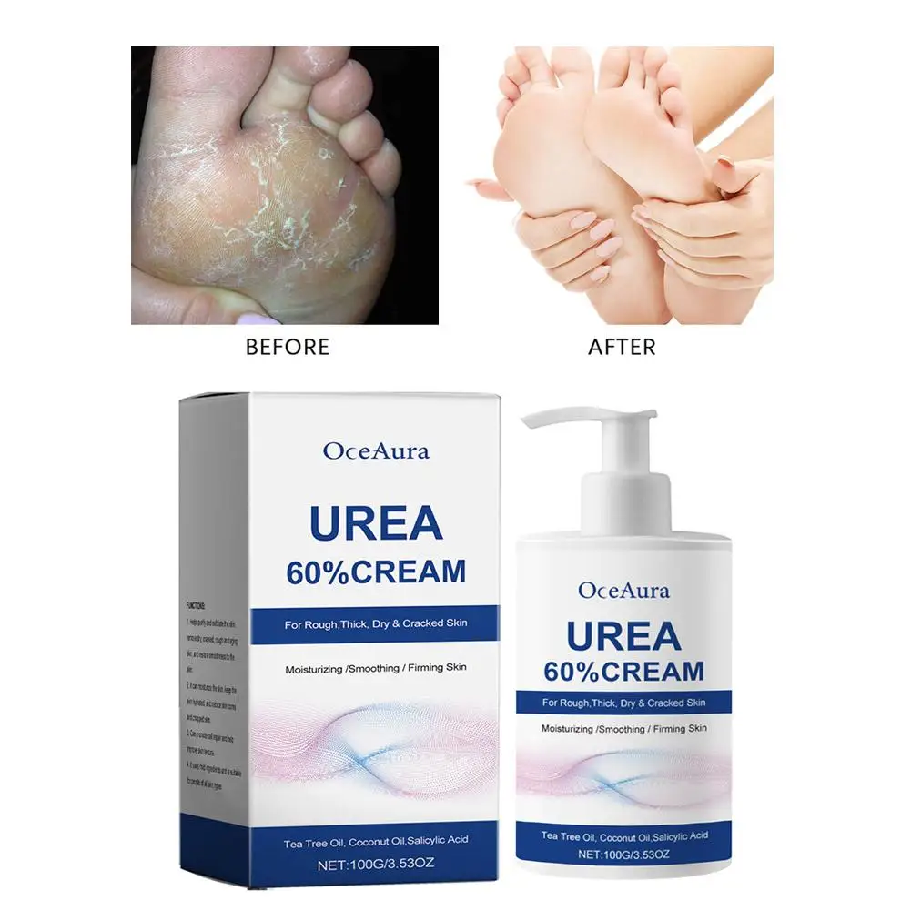 150ml 60% Urea Cream For Feet With Salicylic Acid, Shea Butter&Avocado Oil- Moisturizer For Dry Knees, Elbows, Hands And Heels