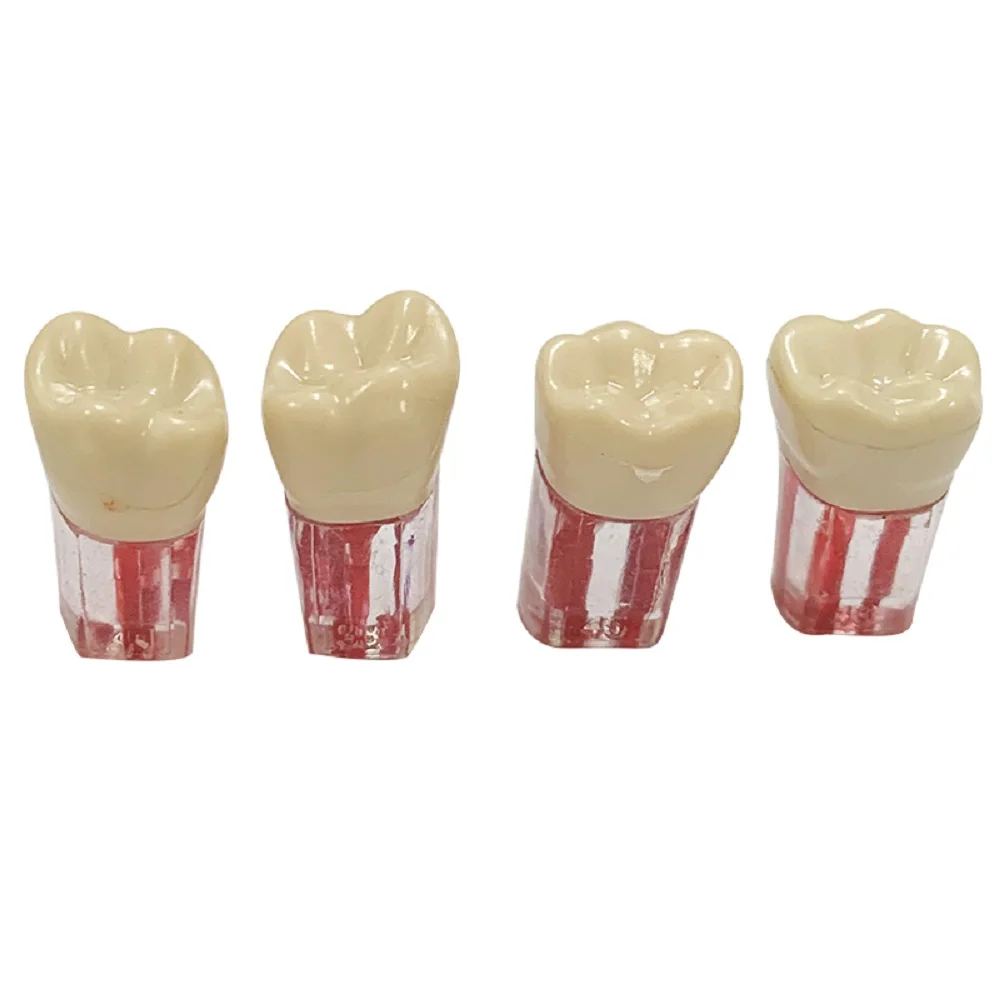 Dental Tooth Model Root Canal Block RCT Practice Teeth Pulp Cavity Resin Teeth Study Endo Training Model Dentistry Product