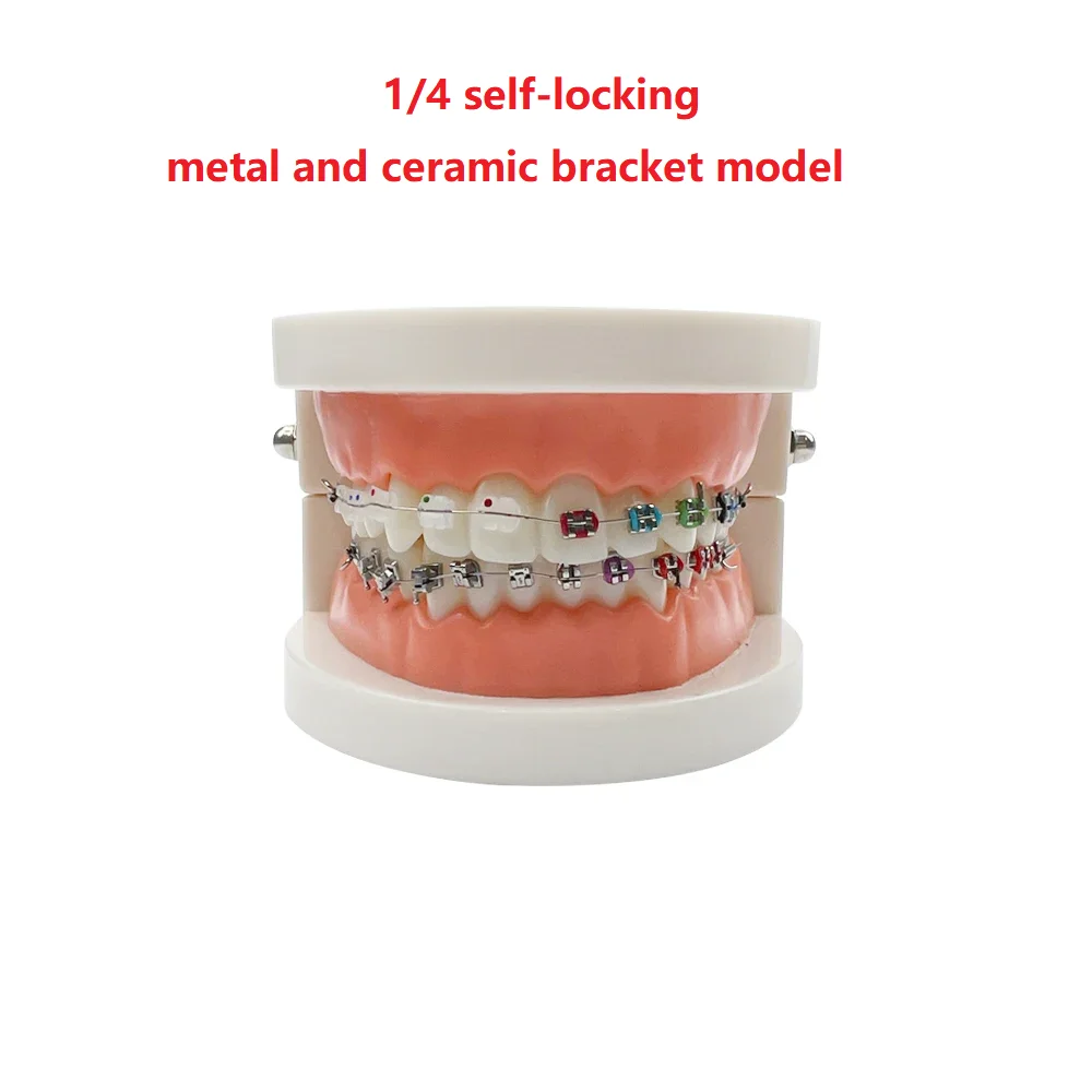 Dental Teaching Modell Standard Dental Kieferorthopädische Zähne Modell Mit Zahnspangen Metall/Keramik Klammern Für Zahnmedizin Bildung Studie