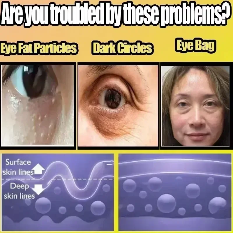 Retinol creme para os olhos levantar das olheiras inchadas sacos para os olhos levantamento hidratante reparação de saúde suavização cuidados com os olhos