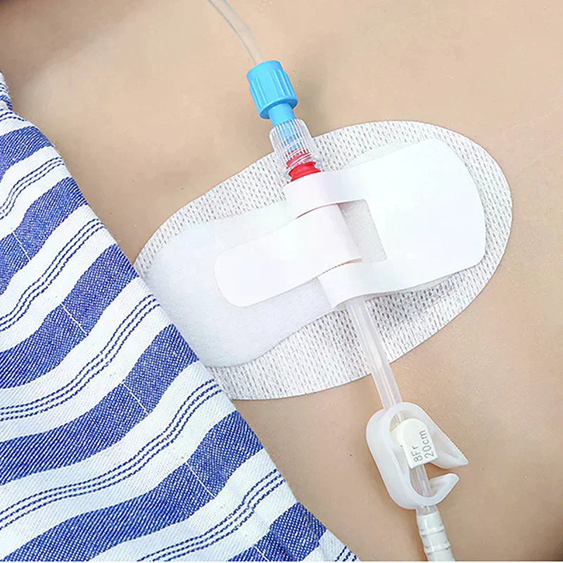 Catheter Holder Tube Sticker Bag Strap Urinary Leg Legband Adhesive Urine Fixing Band Device Anchor G Stabilization Nephrostomy