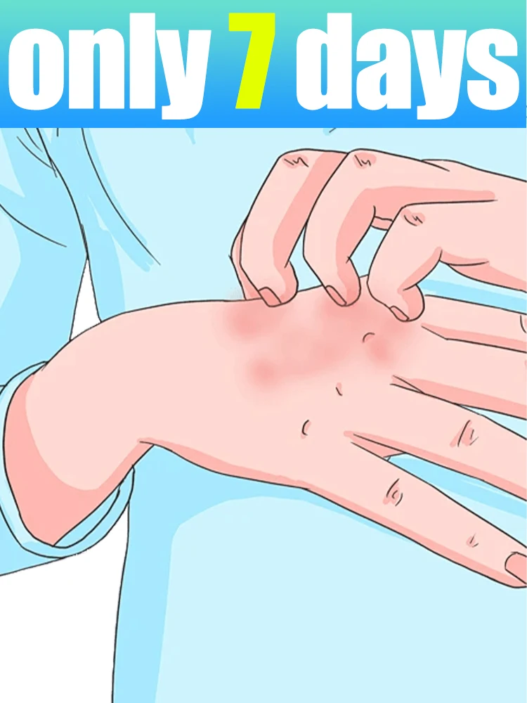 

2025 New formula Prevents chapping Dry flaky skin Cracked heels chilblains Nursing cream Contains squalane for moisturizing