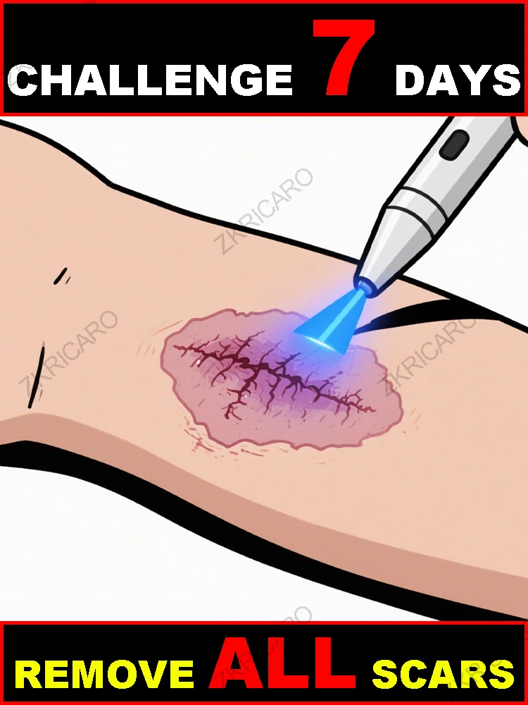 

Устройство синего света решает проблемы шрамов и быстро восстанавливает кожу!