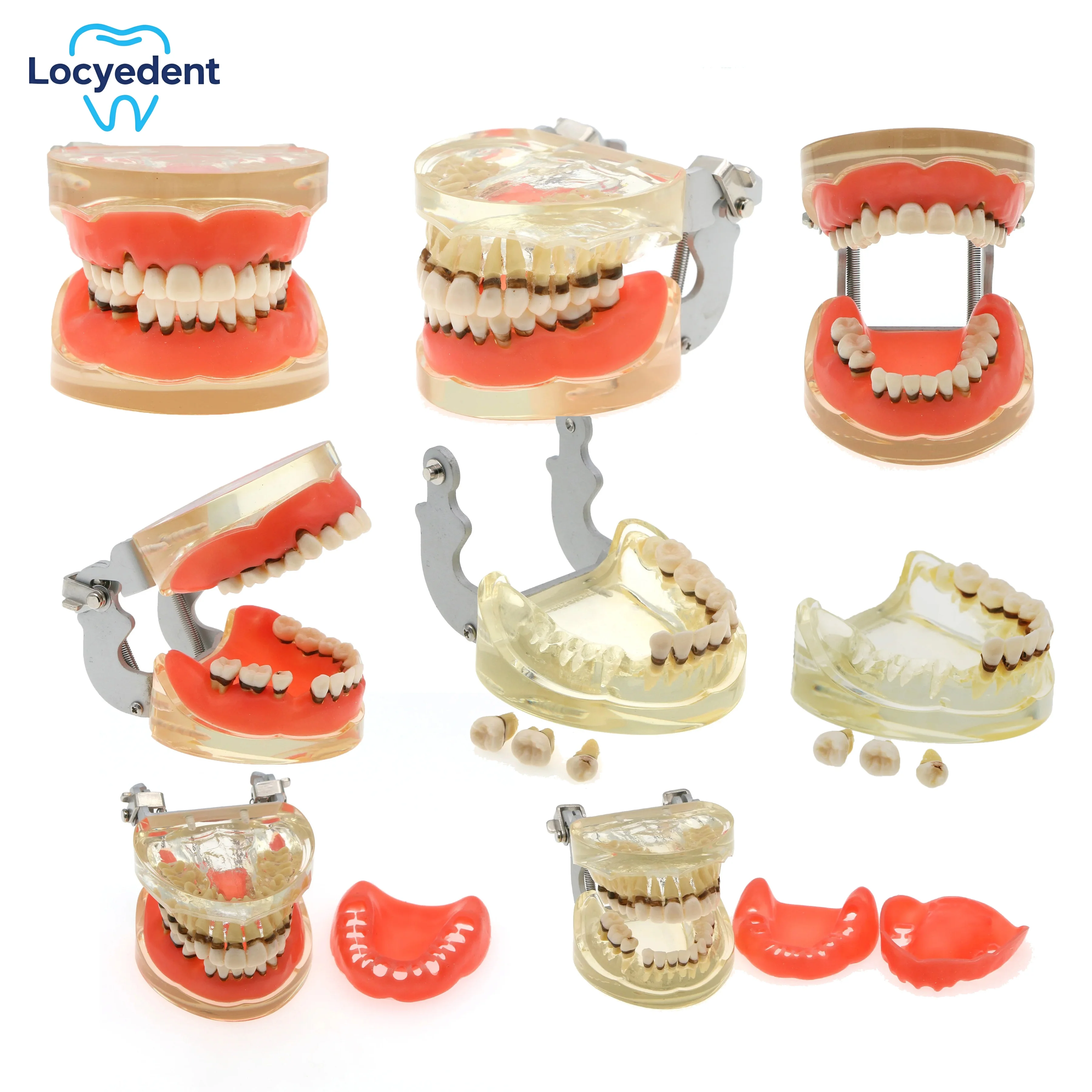 Dental Teeth Model M4017 Periodontal Disease Demonstration Tool for Patient Education And Dentist Teaching on Pathological Teeth