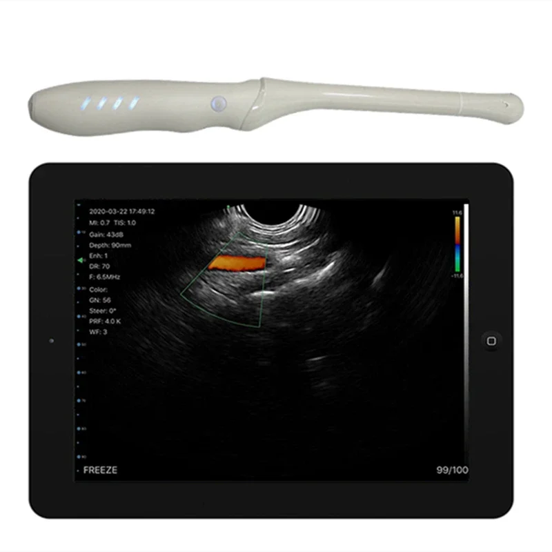 

Handheld 4T Transvaginal Array Endocavity Ultrasonic Wireless Color Doppler Palm Ultrasound Probe