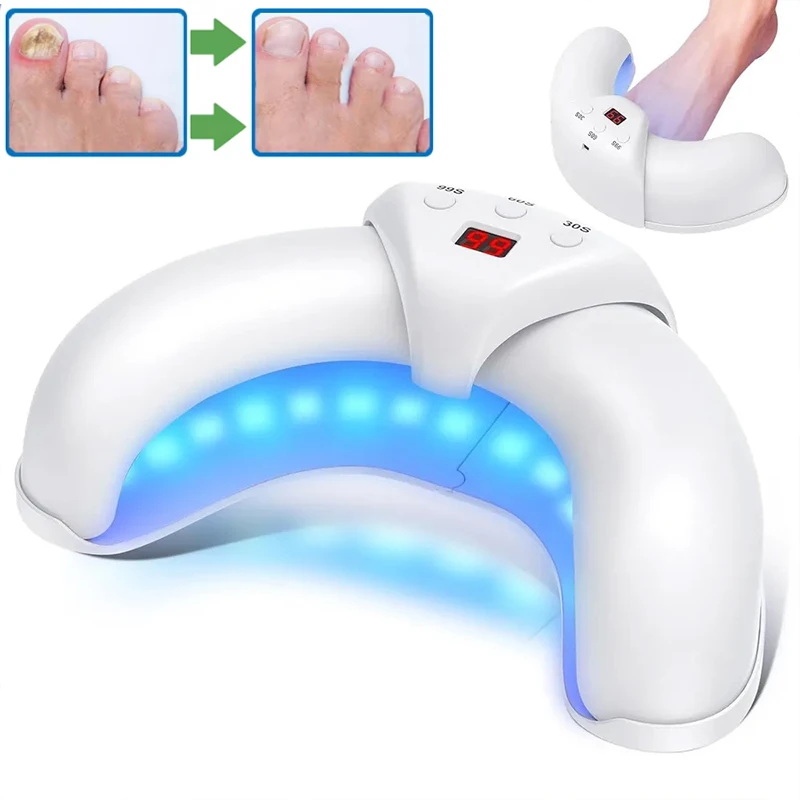 Fungal Nail Device for Rapid Repair of Nails Fungal Onychomycosis Repair of Toenails Removal of Nail Fungi and Treatment