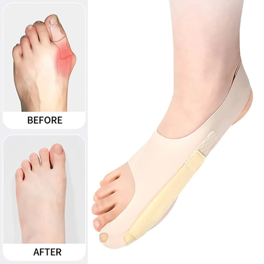 1PC Foot Care Pain Relieve Toe Corrector Adjustable Improve Toe Bunion Corrector Hallux Valgus Toes Separator Women