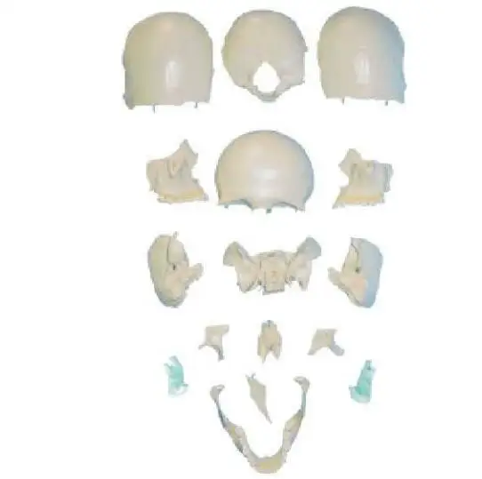 ISO Advanced Scattered bones of skull model, Skull model