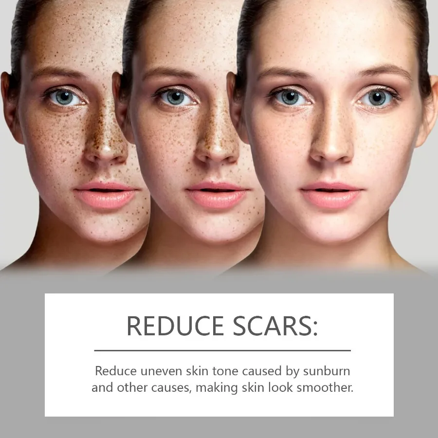 Le sérum réparateur pour la peau WestMonth hydrate doucement la peau du visage améliore l'essence de soin pour la peau terne et éclaircissante