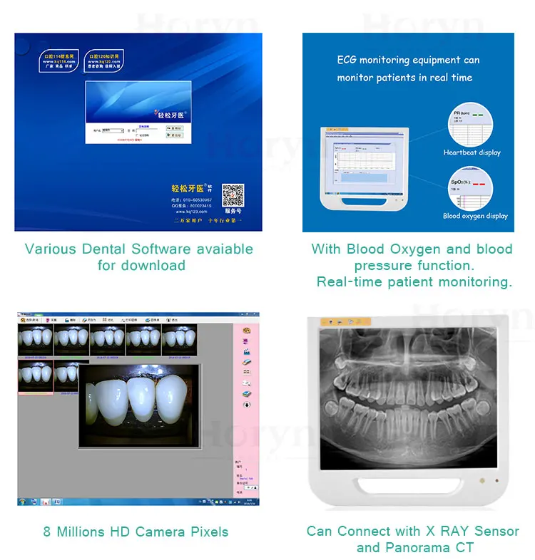 den tal Equipment 17HD LCD Moni tor Computer WIFI High Pixel den tal Intraoral Cam Ära mit Windows