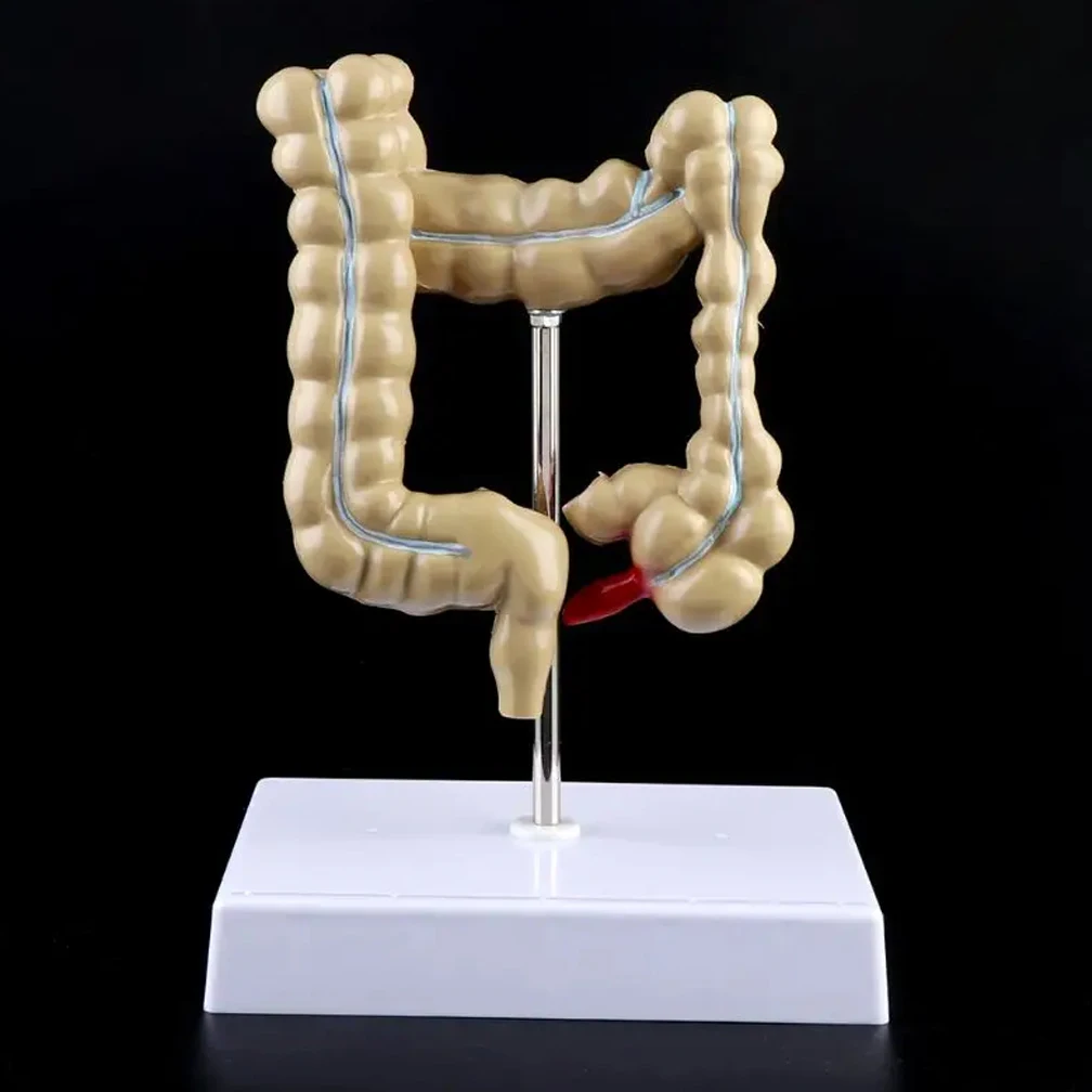 Pathological Anatomy Colon Diseases Intestine Medical Professional Human Colorectal Lesion Model Teaching Learning Tool  Brand