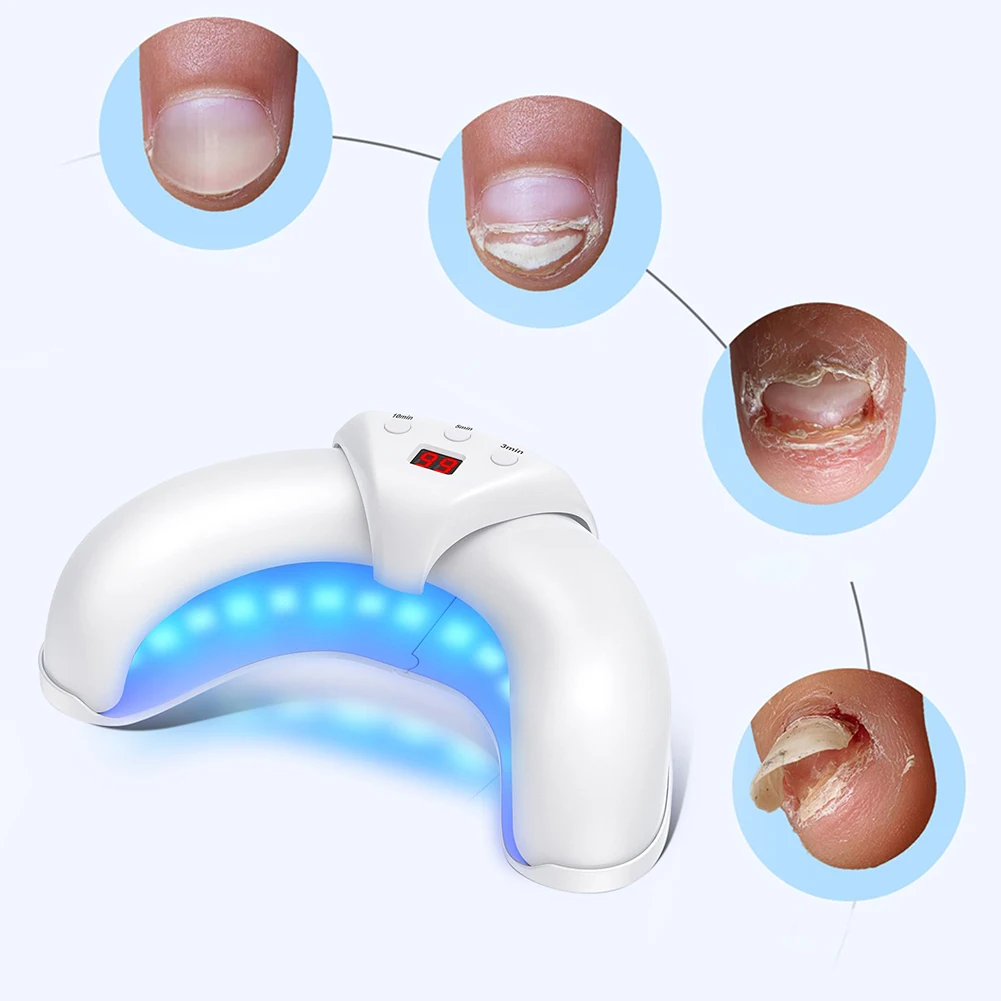 

Nail Fungal Light Device Toenail Fungal Cleaning Machine Portable Nail Fungal Eradication Device for Paronychia Onychomycosis