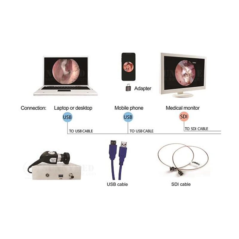 SY-P031HD2 CCD USB endoscope camera ear nasal endoscope usb otoscope For All Rigid Endoscopes