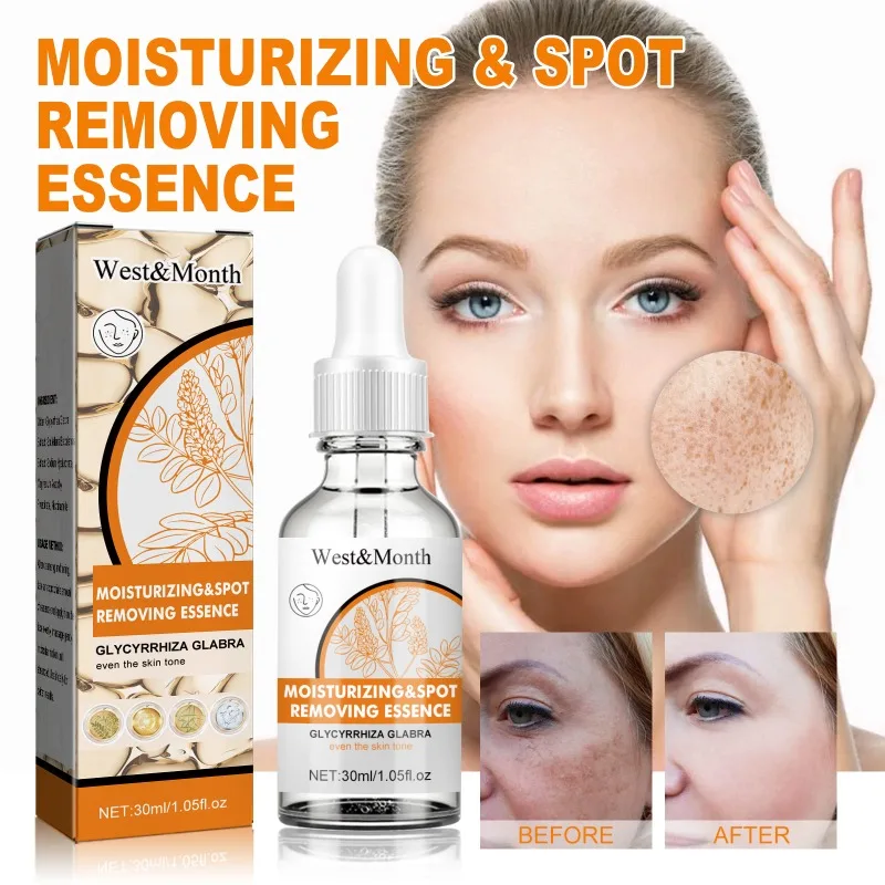 Spot Removing Essence Moisturizing Fade Melasma Freckles Stain Remover Removal Melaninskin Whitening Brighten Freckle Essence