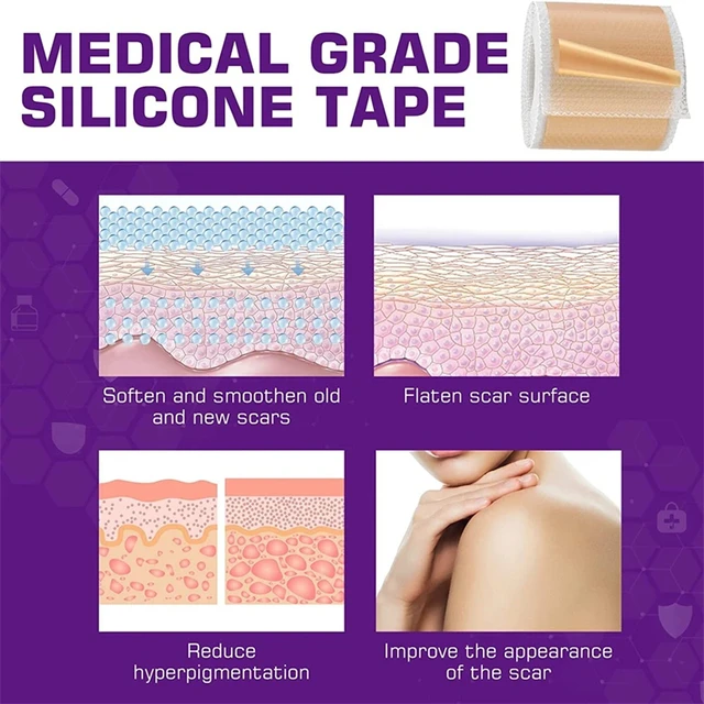 Waterproof & Reusable Silicone Scar Tape – Breathable, Skin-Friendly Adhesive for Ear Protection & Discreet Coverage 4 Waterproof & Reusable Silicone Scar Tape – Breathable, Skin-Friendly Adhesive for Ear Protection & Discreet Coverage 4