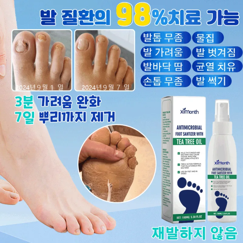 발크림 풋 케어제 드라이 발 뒤꿈치 보습 보습 탈취 리페어제 풋스프레이 진균제거풋스프레이 의료용 진균 제거 풋 스프레이 New
