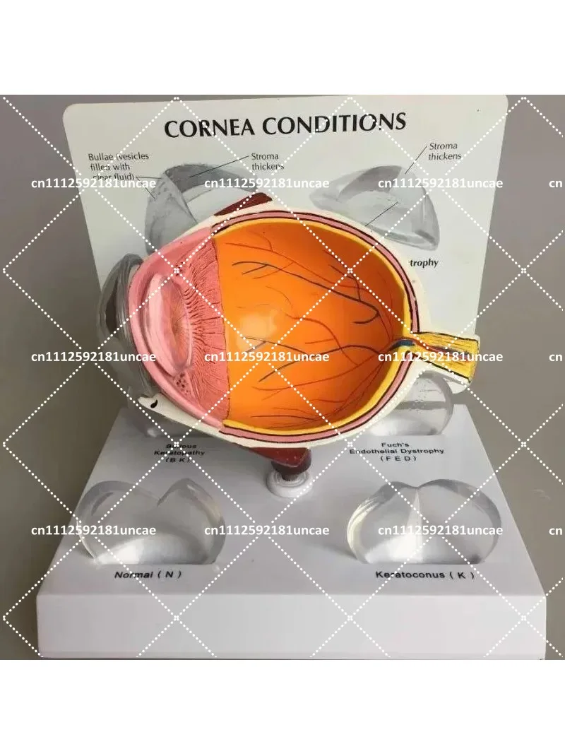 Human Eye Anatomy Model for Science Education Biology Teaching Tool 12x10x8cm