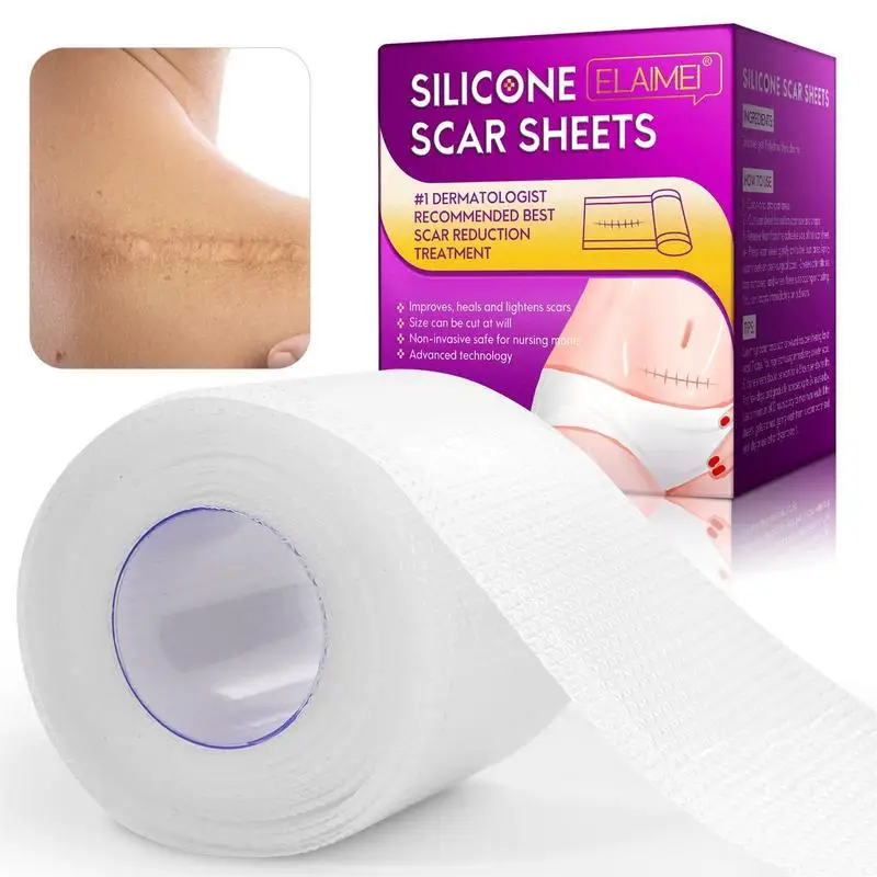 Folha de silicone reutilizável cicatriz remoção, cicatriz Tape Roll, eficaz para o velho e novo, 59x1.6 remoção