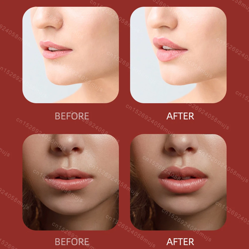 Lip Plumper Automatic Lip Filler Beauty Tool Electric Plumping Device Fuller Bigger Thicker Lips Collagen Lip Beauty Device