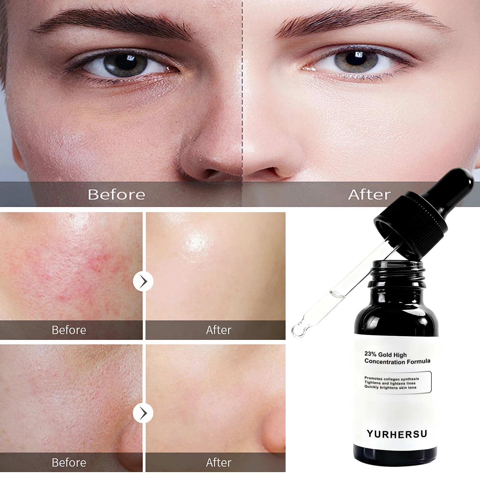 Solução de Essência Facial com 23% de Vitamina C, Antioxidante, Firmadora e Hidratante para Todos os Tipos de Pele