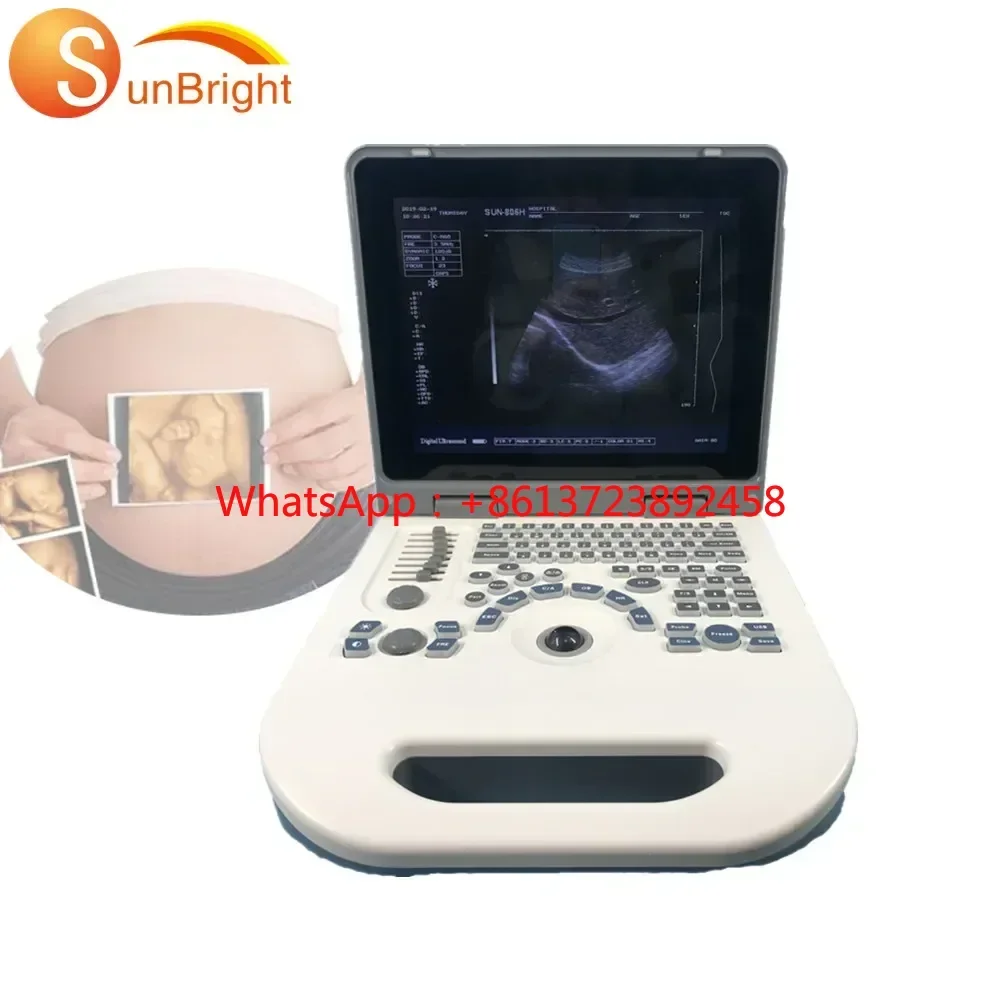 Cheapest price Sunbright portable ultrasound 2D medical diagnostic ultrasound machine