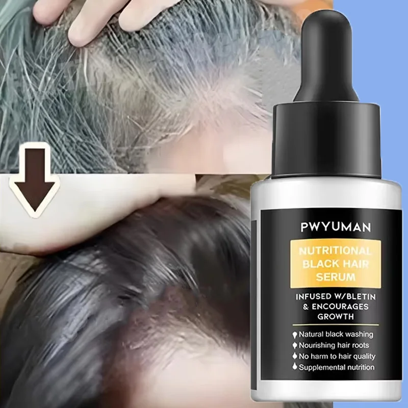 

Gray White Hair Treatment Serum White To Black Repair Natural Color Black Rice Nourish Product Anti Loss Hair Care For Men Women
