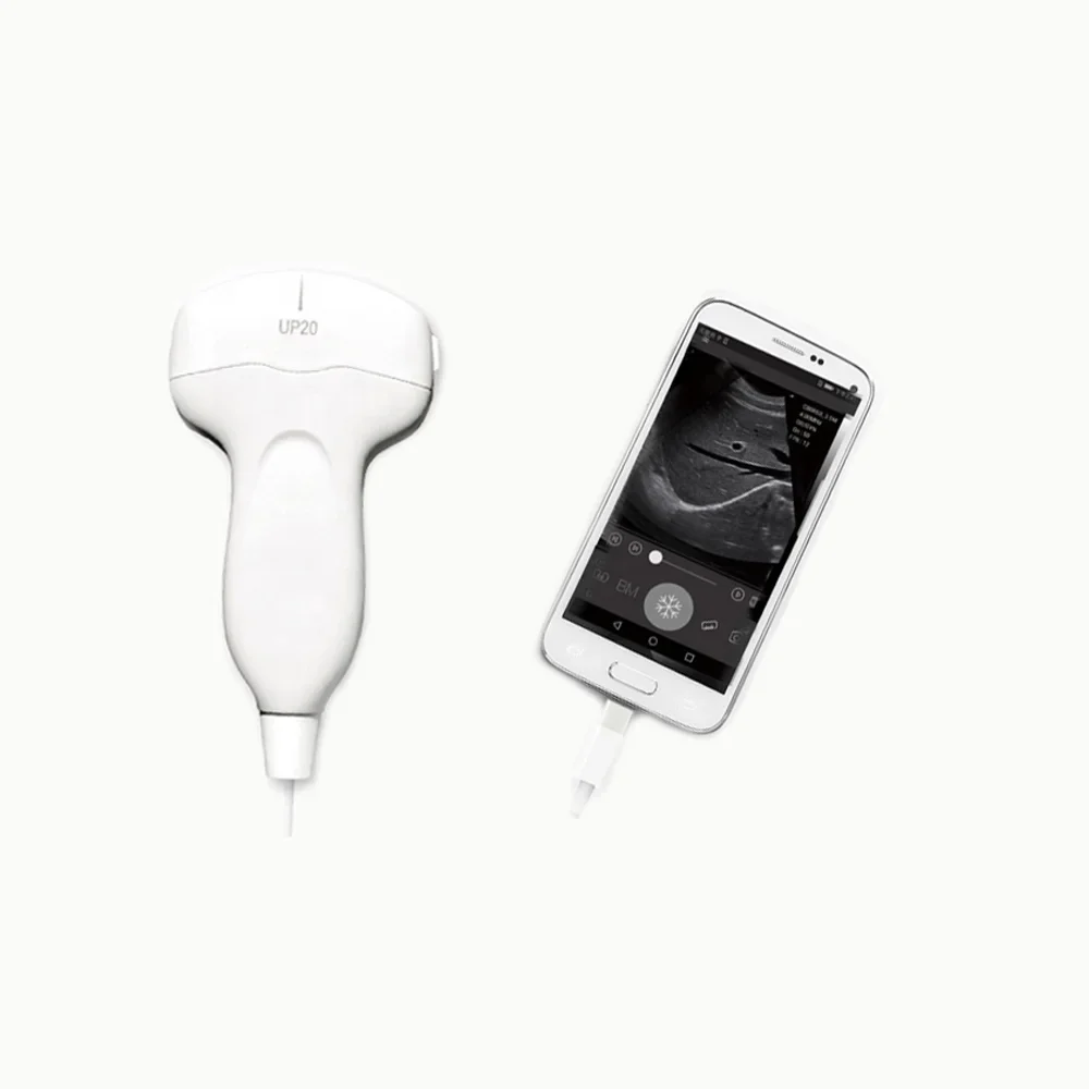 High Quality Latest Portable Smartphone Ultrasound Machine USB Probe Price