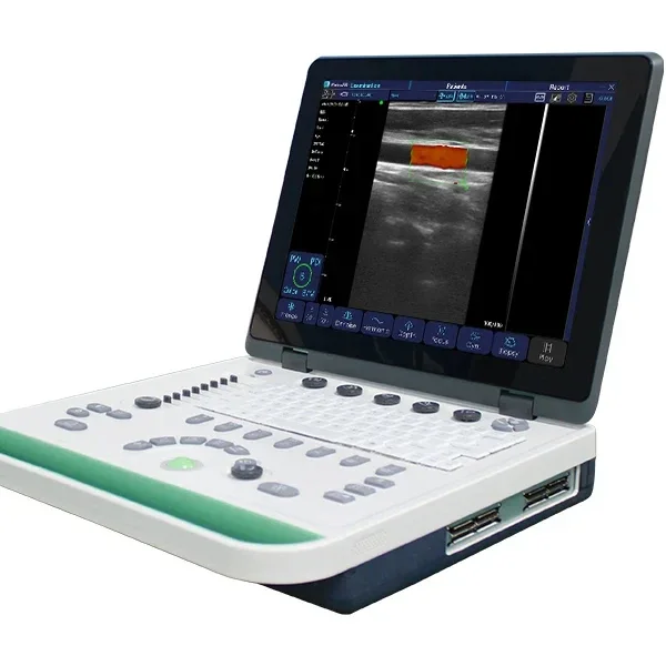 Laptop color Doppler machine