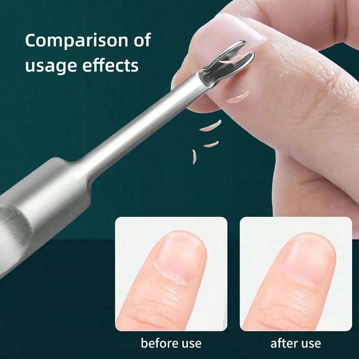 Stainless Steel Nail Care Set For Dead Skin And Calluses, Cuticle Remover Tools Kit, Precision Cutting Edge For Smooth Removal