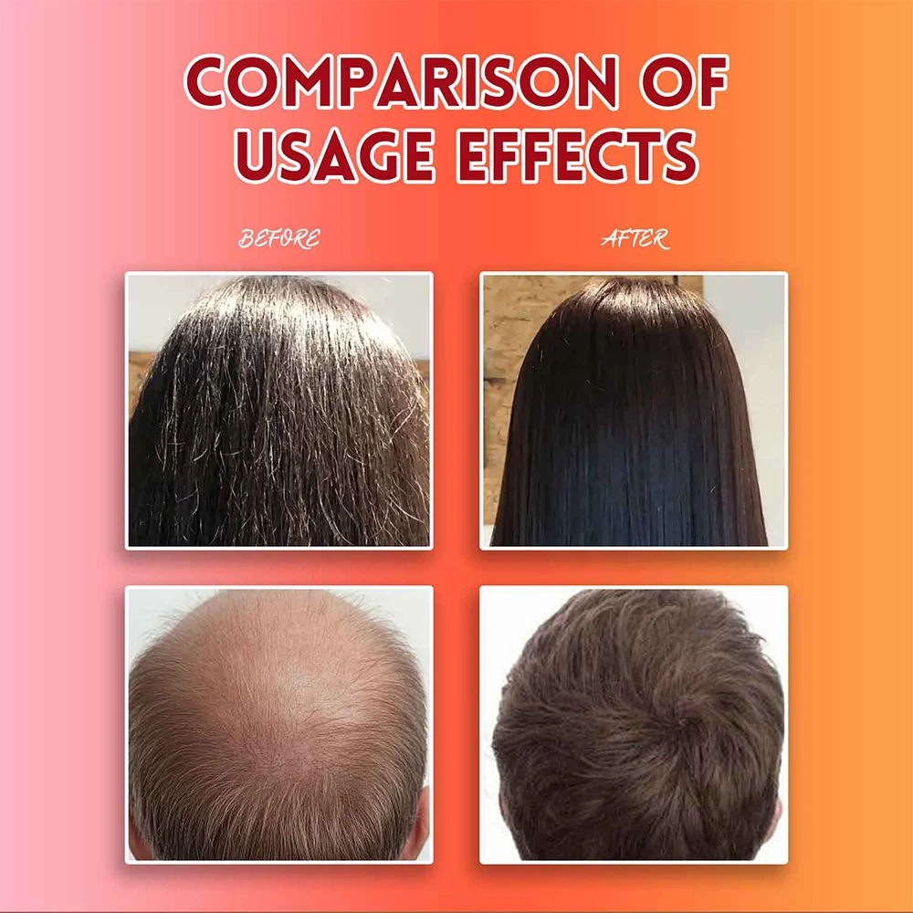 바타나 오일 샴푸, 탈모 방지 제품, 천연 바타나 샴푸, 딥 클렌징 모이스처라이징 두피, 샤인 헤어 케어