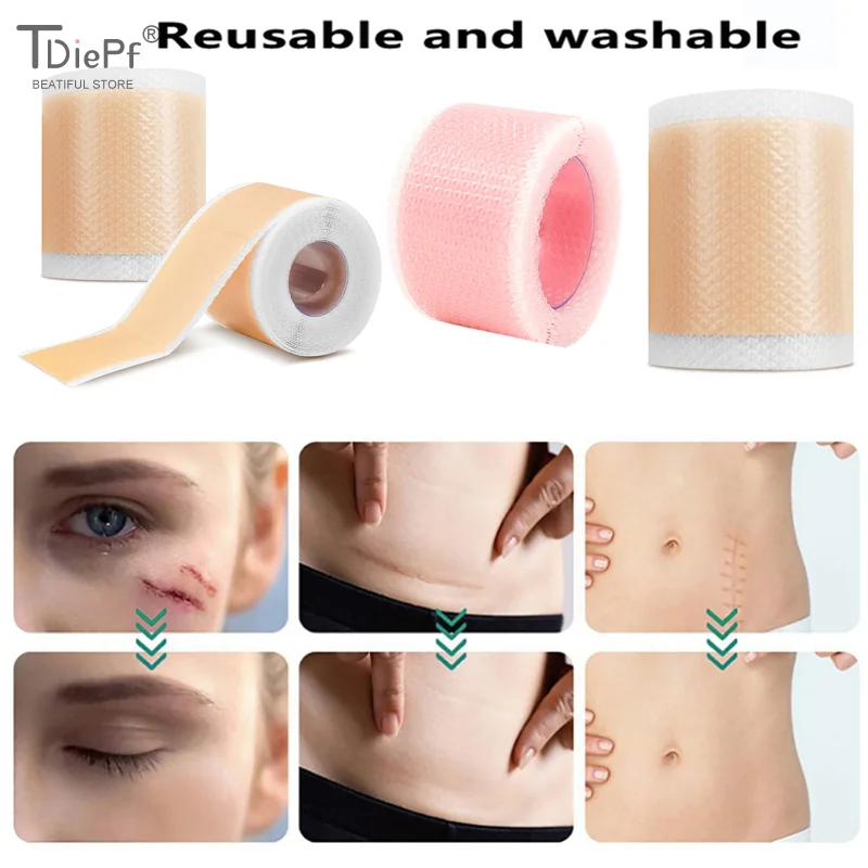 1 Roll  Silicone Gel Scar Sheets Self-Adhesive Scar Cover Tape Reusable And Effective Skin Care Strips Waterproof And Breathable