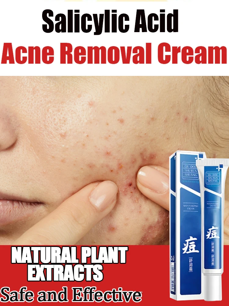 

Anti-Acne Pore Shrinking Cream Blackehead Acne Treatment Clear Skin Brighten Whiten Moisturize Eliminate acne skin care Soothes