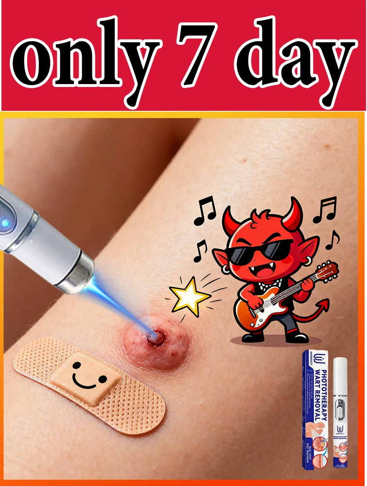 

ʙʟᴜᴇ ʟɪɢʜᴛ ᴘᴇɴ sᴏʟᴠᴇ ᴡᴀʀᴛs, ʜᴏᴛ sᴀʟᴇ ᴡᴀʀᴛ ᴄᴀʀᴇ ᴛᴏᴏʟs